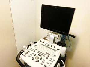 超音波診断装置
